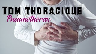 TDM THORACIQUE  Pneumothorax de petite à moyenne abondance [upl. by Capp679]