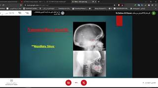 Growth amp development  Nasomaxillary growth  DrSelme Merza orthodontic [upl. by Enalahs]