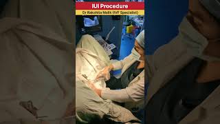 IUI Procedure  intrauterine insemination procedure  by Dr Rakshita Malik ivfcenter iuitreatment [upl. by Bainter]