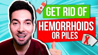 How to get rid of hemorrhoids fast with treatment [upl. by Atilegna610]