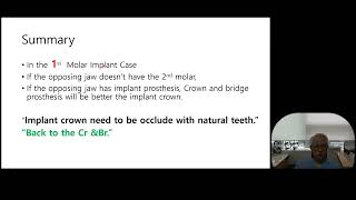 Lecture summary Back to CrownampBridge  A better option than dental implants [upl. by Engel]