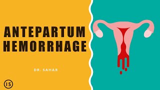 Antepartum Hemorrhage  Dr Sahar  Lecture 15 [upl. by Sillek]