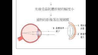 HKDSE 生物科 概念重溫篇：第15課（5） 眼球之光暗、遠近調節 [upl. by Buseck]