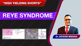 High Yielding Shorts32 HYS32  Reye Syndrome by Dr Devesh Mishra [upl. by Deloris909]