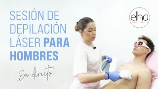 Sesión de depilación láser masculina en directo  Elha Laser amp Beauty [upl. by Recor]