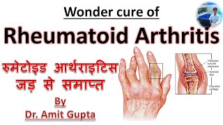 Rheumatoid arthritis cured case Permanent cure of Rheumatoid arthritis [upl. by Asa]