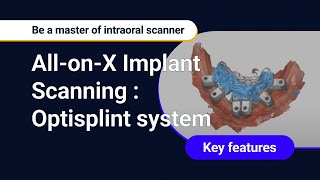 AllonX Implant Scanning  Optisplint system [upl. by Dav255]