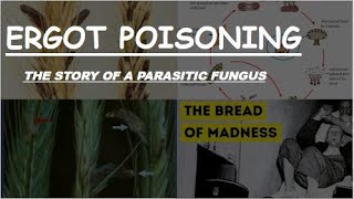 Ergot Poisoning quotThe Bread of Madnessquot Drugs of Plant Origin  toxicology medicine  Novice Medic [upl. by Norina431]