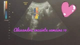 Alexandra enceinte  semaine 10 [upl. by Nwahsud]