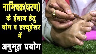 Naval Diplacement नाभिचक्र Nabhi Chakra धरण Naval का सटीक ईलाज Naval setting by yoga amp acupressure [upl. by Omer]