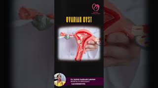 Understanding Gynecological Causes of Abdominal Pain in Women  gynecologist abdominalpain [upl. by Dagnah86]