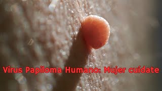 VIRUS PAPILOMA HUMANO CUÍDATE MUJER [upl. by Kawai]