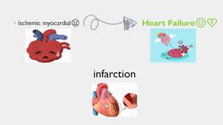 Chronic Ischemic Heart Disease CIHD [upl. by Rimisac739]