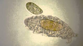 Water bear Tardigrade meets Paramecium [upl. by Arthur]