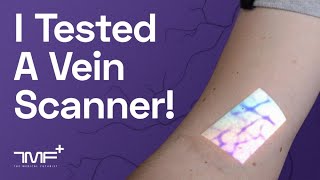 Testing a Vein Scanner  The Medical Futurist [upl. by Reivaj]