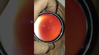 Digital fundoscopy fundus eye retina [upl. by Donadee]