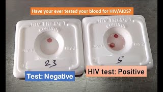 Know your HIV status within half an hour HIV test positive HIV TRI DOT [upl. by Ennayehc226]