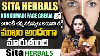 Sita HERBALS  Best Fairness Cream for Skin Whitening  Skin Care Tips  Reduce Pimples Dark Spots [upl. by Eenahpets593]