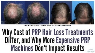 Factors of Differing Costs of PRP Hair Loss Treatments and Why Expensive PRP Machines are Unproven [upl. by Notlaw451]