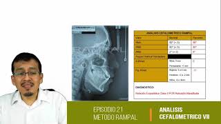 Cefalometría VIII Evaluación de Vertebras Cervicales [upl. by Aisorbma]