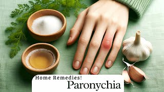 Get Rid of Painful Paronychia Naturally Home Remedies [upl. by Llenil]