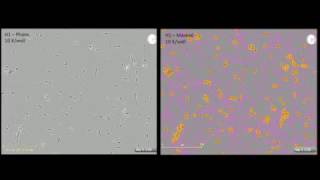 Study of Neurite Dynamics using NeuroTrack Assay [upl. by Inah]