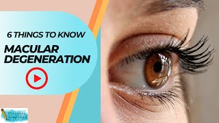 Macular Degeneration 6 Things To Know [upl. by Navets235]