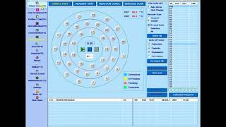 How to run Creatinine Clearance on ERBA Chemistry Analyzer [upl. by Gninnahc169]