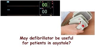 May defibrillator be useful for patients in asystole [upl. by Eninahs]