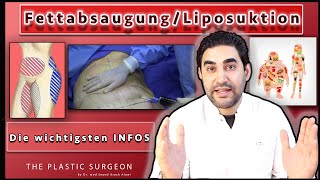 Die wichtigen Infos zur Fettabsaugung Liposuktion  Dr Alawi [upl. by Nongim]