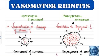 ENT 🔥II VASOMOTOR RHINITIS II RHINITIS MEDICAMENTOSA II NONALLERGIC RHINITIS II EASY EXPLANATION I [upl. by Nois307]