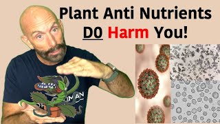 Are Plant AntiNutrients Harming You antinutrients oxalate [upl. by Ahsirtal]