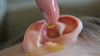 Natural Remedies for Ear Infection [upl. by Papageno]