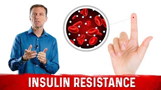 Understanding Insulin Resistance amp What You Can Do About It – DrBerg [upl. by Elenore886]