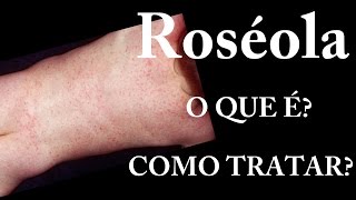 Roséola  O que é  Sintomas  Tratamento [upl. by Lednyc]