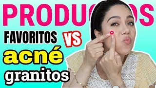 PRODUCTOS FAVORITOS PARA EL ACNÉ Y LOS GRANITOS  MARIEBELLE COSMETICS [upl. by Aissat]