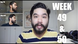 Week 49 amp 50  Minoxidil Beard Journey [upl. by Arri38]