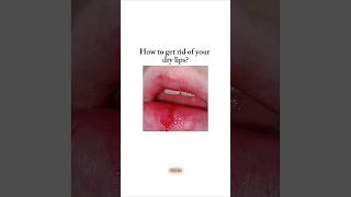 How to get rid of dry lips 🎀 fyp shorts viral viralshorts kpop bts aesthetic beauty [upl. by Siram]