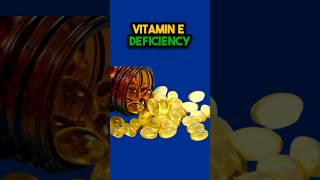 Most POWERFUL Vitamin E Benefits To REPAIR amp Heal vitamine nutritiontips [upl. by Dermott]