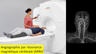 Angiographie par résonance magnétique cérébrale ARM [upl. by Ameen978]