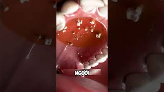 Hyperdontia bạn đã biết chưa dentist facts nhakhoa teeth [upl. by Ennahoj]