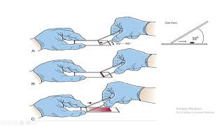 Preparation of peripheral blood smear [upl. by Sparky]