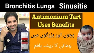 Antimonium tart homeopathic medicine uses antim tart 30 200 benefits  Dr Sherazi Homeopathic [upl. by Weidar490]