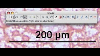 Imagej Tutorial  How to Set scale bar in SEMTEM Micrograprah using imagej [upl. by Cobby390]