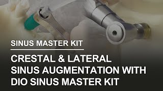 DIO Sinus Master Kit handson video [upl. by Nevins]