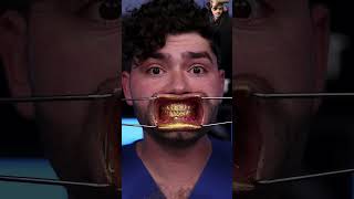 Gold teeth with golden toothpaste 🦷 yt viral ytshorts argal [upl. by Studdard219]