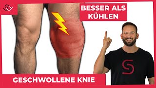 Geschwollene Knie  DAS musst du wissen  hilfreicher Trick [upl. by Tisman]