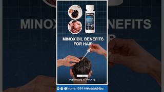 Minoxidil Hair Regrowth Results ytshorts shortsvideo minoxidil [upl. by Subocaj]