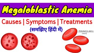 Megaloblastic Anemia क्या होता है Part1  Vitamin B12 deficiency anemia [upl. by Aniala]