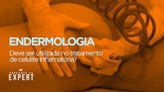 Endermologia no tratamento da celulite funciona  Pergunte 14 [upl. by Ludmilla]